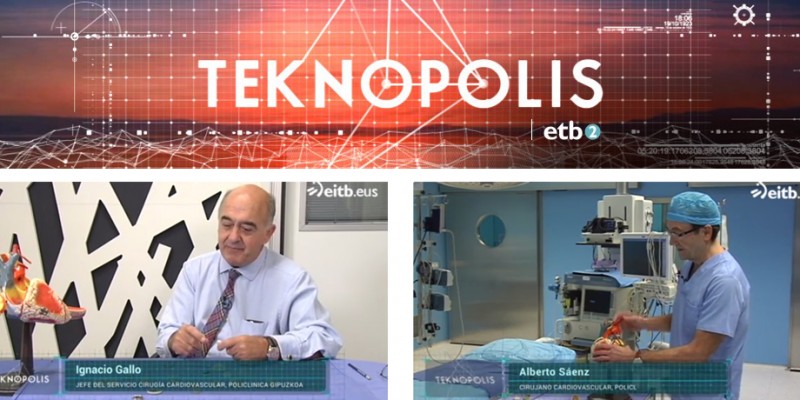 El Servicio de Cirugía Cardiovascular de Policlínica Gipuzkoa ha participado en el programa "Teknopolis" de ETB