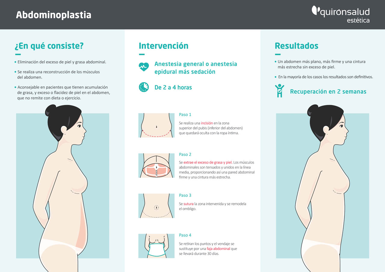 Abdominoplastia Abdominoplastia