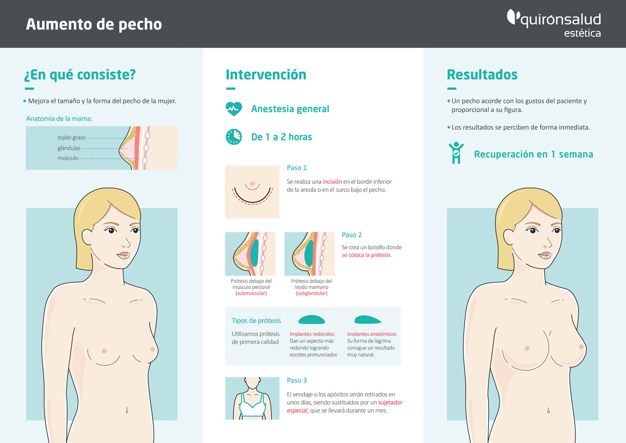 Qué sujetador usar después de una operación de pecho?